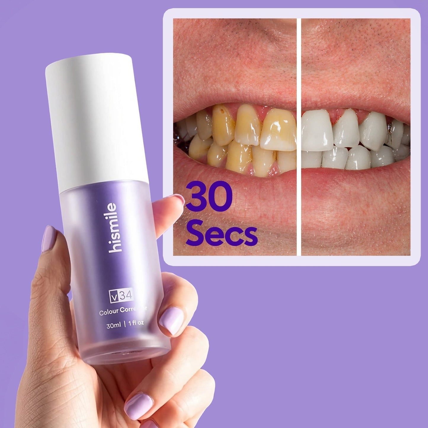 HiSmile V34 Colour Corrector Serum | Whitening Booster | Stain Remover